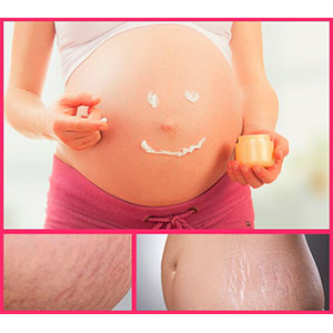 Crema antiestrías efectivas en el embarazo